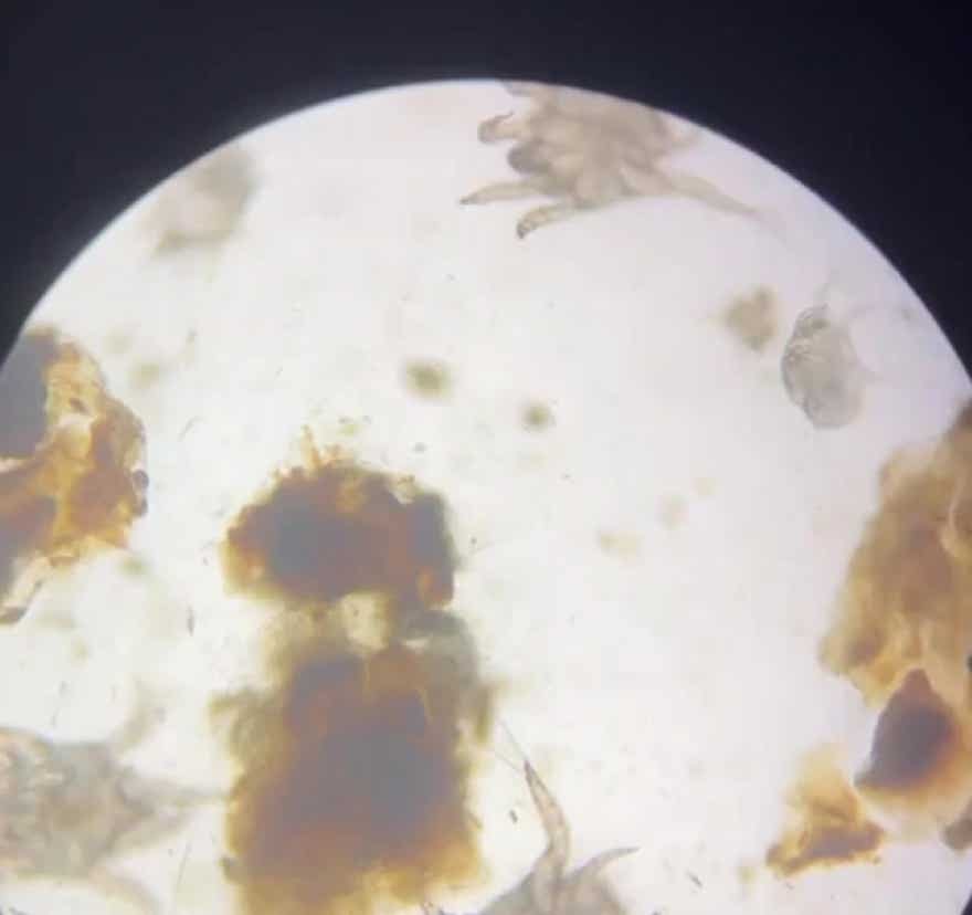 Veterinaria observando sarna a través del microscopio en la clínica veterinaria El Jardín.