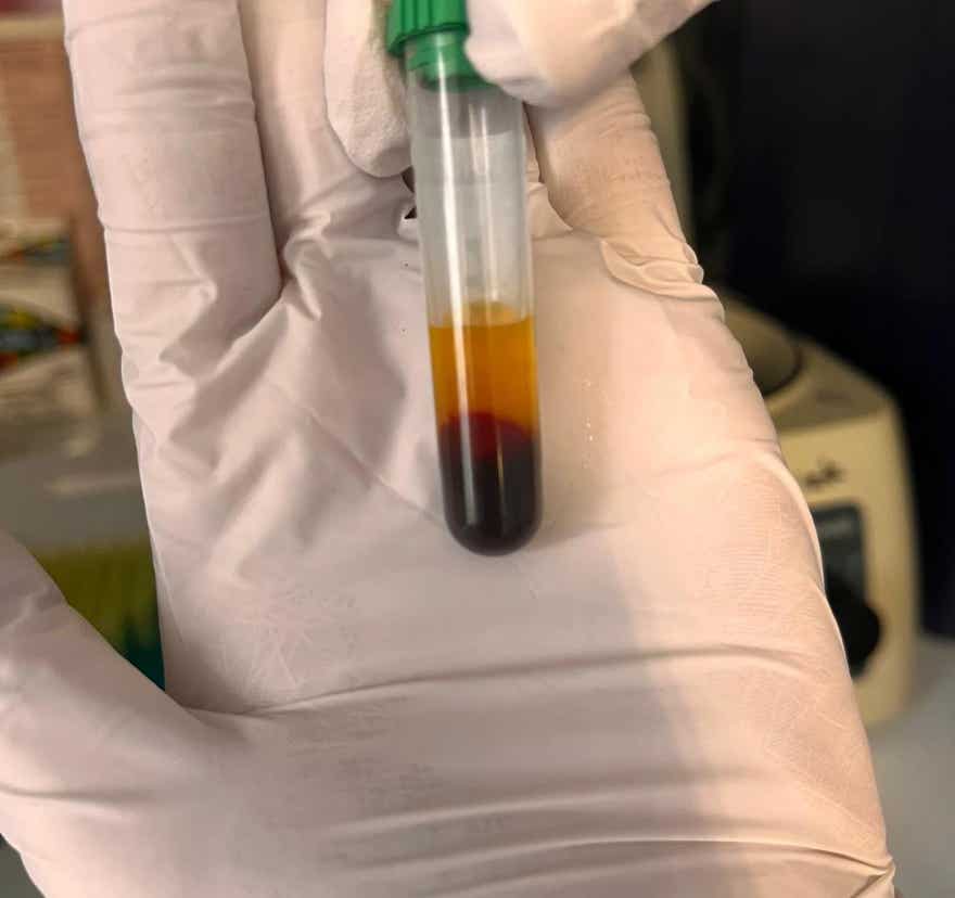 Veterinaria analizando muestra de sangre en el laboratorio de la clínica veterinaria El Jardín.